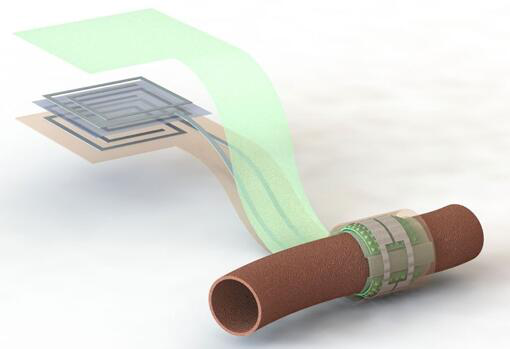 上圖描繪了這款可生物降解的壓力傳感器，它圍繞著一根血管，天線在左側(cè)(分離的層狀結(jié)構(gòu)，展示了天線結(jié)構(gòu)的細(xì)節(jié))